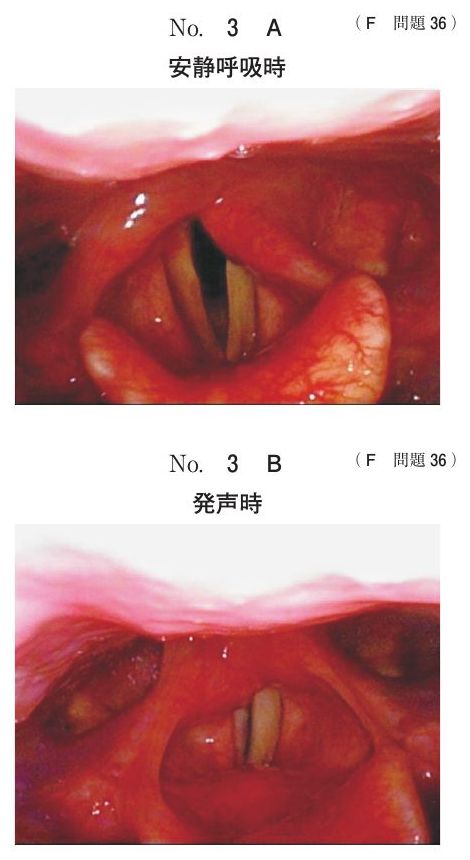 別冊 No.3 A・B