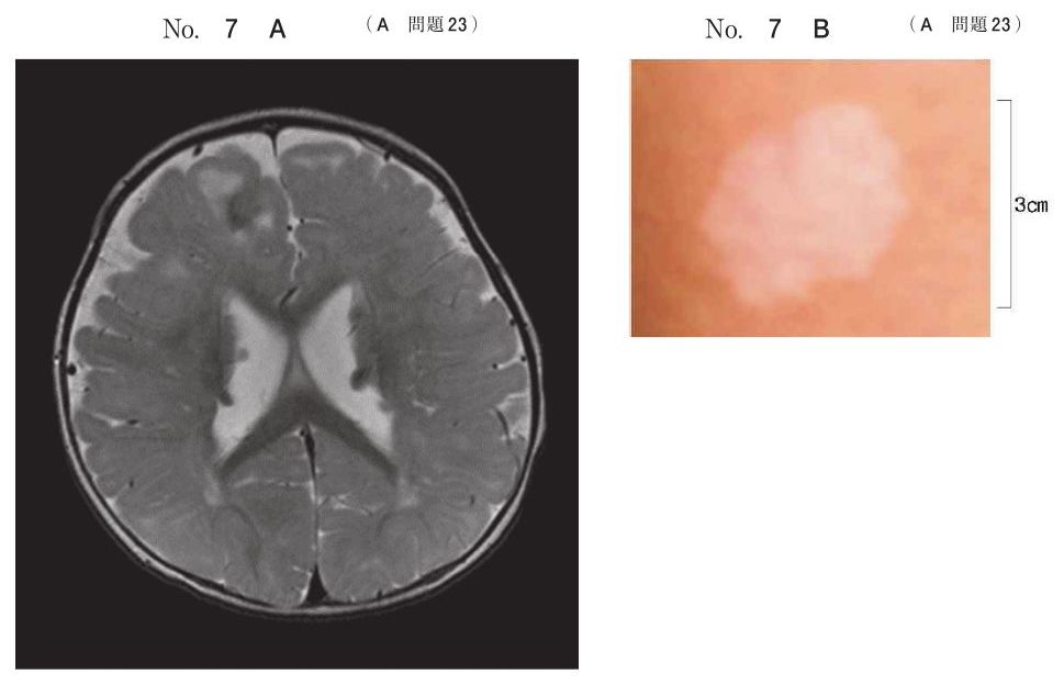 別冊 No.7 A・B
