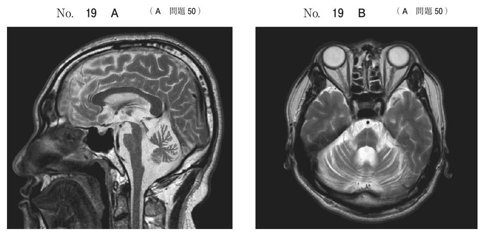 別冊 No.19 A・B