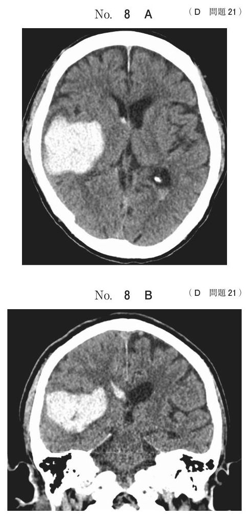 別冊 No.8 A・B