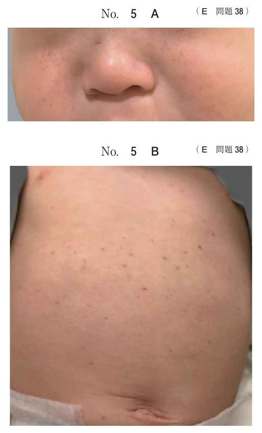 別冊 No.5 A・B