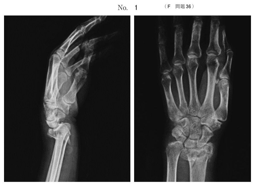 別冊 No.1